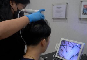 Cek Kondisi Rambut Pasti Tumbuh